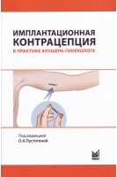 Имплантационная контрацепция в практике акушера-гинеколога. Пустотина О.А.