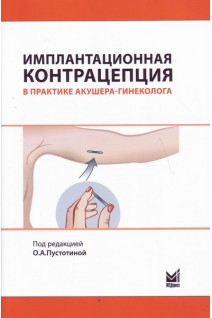 Имплантационная контрацепция в практике акушера-гинеколога. Пустотина О.А.
