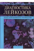 Диагностика лейкозов. Атлас и практическое руководство.. Глузман Д.Ф