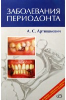 Заболевания периодонта. Артюшкевич