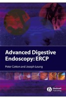 Advanced Digestive Endoscopy: ERCP. Peter B. Cotton Joseph W. Leung