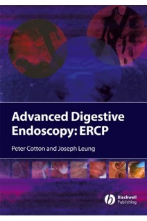 Advanced Digestive Endoscopy: ERCP. Peter B. Cotton Joseph W. Leung