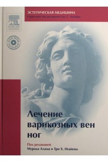 Лечение варикозных вен ног + DVD. Серия эстетическая медицина. Мурада Алам Нгайен Три Х. Доувер Дж.