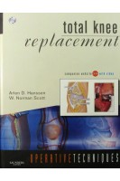 Operative Techniques: Total Knee Replacement. Arlen D. Hanssen and W. Norman Scott MD