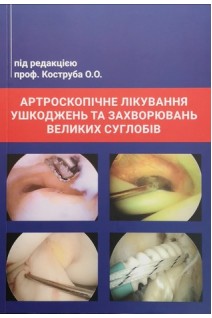 Артроскопічне лікування ушкоджень та захворювань великих суглобів. Коструб О.О.