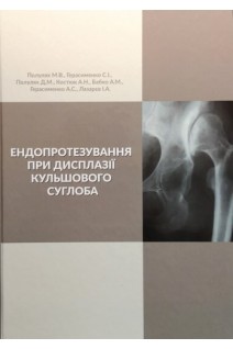 Ендопротезування при дисплазії кульшового суглоба. Полулях М.В.