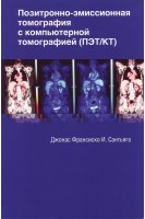 Позитронно-эмиссионная томография с компьютерной томографией. Сантьяго Дж. И. 