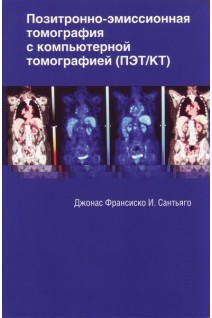Позитронно-эмиссионная томография с компьютерной томографией. Сантьяго Дж. И. 