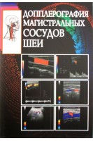 Допплерография магистральных сосудов шеи. Абдуллаев Р.Я. Калашников В.Й. Марченко В.Г.