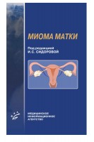 Миома матки. Сидорова И.С.