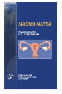 Миома матки. Сидорова И.С.