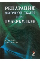 Репарация легочной ткани при туберкулезе. Тарасова Л.Г