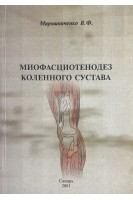 Миофасциотенодез коленного сустава (БУ). Мирошниченко В.Ф.