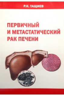 Первичный и метастатический рак печени. Тащиев Р.К.