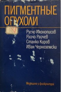 Пигментные опухоли (БУ). Иконописов Р.