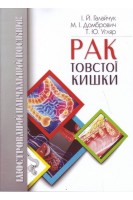 Рак товстої кишки (ілюстрований навчальний посібник). Галайчук І.Й Домбрович М.І. Угляр Т.Ю.