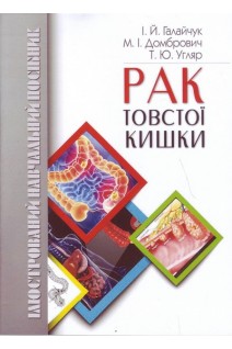 Рак товстої кишки (ілюстрований навчальний посібник). Галайчук І.Й Домбрович М.І. Угляр Т.Ю.
