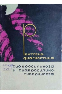 Рентгенодиагностика сидеросиликоза и сидеросиликотуберкулеза (БУ). Шумаков А.Г.