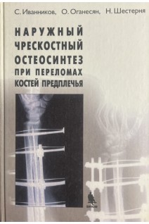 Наружный чрескостный остеосинтез при переломах  костей предплечья. Иванников С. Оганесян О. Шестерня Н.