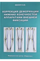 Коррекция деформаций нижних конечностей аппаратами внешней фиксации. Веклич В.В.