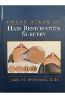 Color Atlas Of  Hair Restoration Surgery. Swinehart J.M.