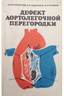 Дефект аортолегочной перегородки (БУ). Бураковский В.И.