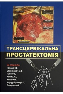 Трансцервікальна простатектомія. Навчальний посібник. Горовий В.І.