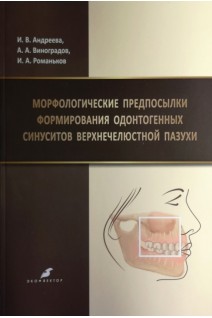 Морфологические предпосылки формирования одонтогенных синуситов верхнечелюстной пазухи. Андреева И.В. Виноградов А.А. Романьков И.А.