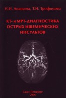 КТ- и МРТ-диагностика острых ишемических  инсультов. Ананьева Н.И.