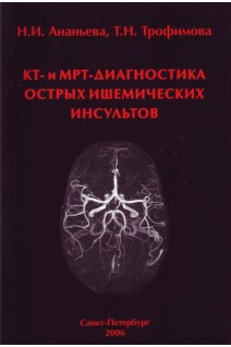 КТ- и МРТ-диагностика острых ишемических  инсультов. Ананьева Н.И.