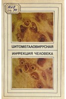 Цитомегаловирусная инфекция человека (БУ). Демидова С.А.