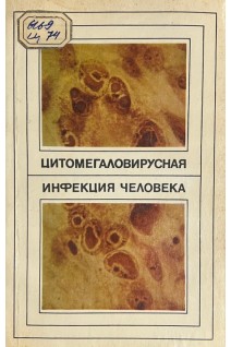 Цитомегаловирусная инфекция человека (БУ). Демидова С.А.