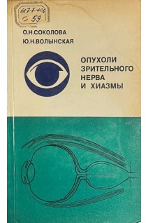 Опухоли зрительного нерва и хиазмы (БУ). Соколова О.Н.