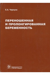 Переношенная и пролонгированная беременность. Чернуха Е.А.