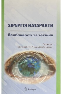 Хірургія катаракти. Особливості та техніки. Крістофер Ліу Ахмед Шалабі Бардан