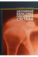 Адгезивный капсулит плечевого сустава. Страфун С.С. Сергиенко Р.А.