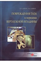 Повреждения таза и переломы вертлужной впадины. Анкин Н.Л. Анкин Л.Н.