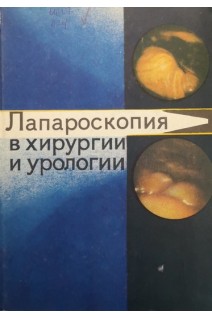 Лапароскопия в хирургии и урологии (БУ). Сотников В.Н. и др.