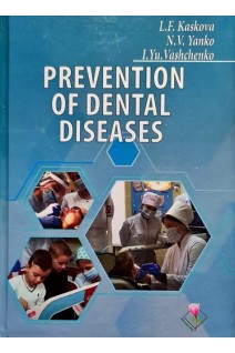 Prevention of Dental Diseases (Профілактика стоматологічних захворювань). Каськова Л.Ф.