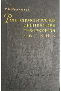 Рентгенологическая диагностика туберкулеза легких (БУ). Помельцов К.В.