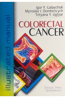 Colorectal Cancer (Рак товстої кишки). Igor Y. Galaychuk (Галайчук І.Й Домбрович М.І. Угляр Т.Ю.)