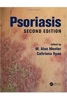 Psoriasis Second Edition. M. Alan Menter Caitriona Ryan