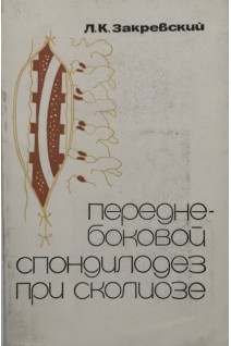 Передне-боковой спондилодез при сколиозе (БУ). Закревский Л.К.