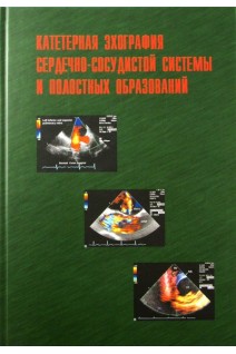 Катетерная эхография сердечно-сосудистой системы и полостных образований + CD. Сандриков В.А. Демин В.В. Ревуненков Г.В.