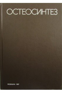 Остеосинтез (БУ). Ткаченко С.С.