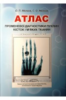 Атлас променевої діагностики пухлин кісток і м'яких тканин (навчальний посібник). Мягков О.П. Мягков С.О.