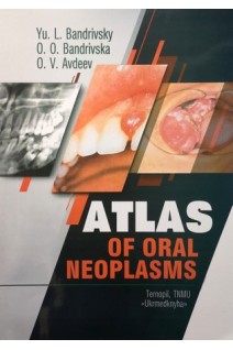 Atlas of oral neoplasms (Атлас новоутворень щелепно-лицевої ділянки). Bandrivsky Yu.L. (Бандрівський Ю.Л.)