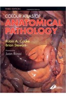 Colour Atlas of Anatomical Pathology 3rd Edition. Robin A. Cooke Brian Stewart