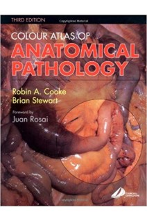 Colour Atlas of Anatomical Pathology 3rd Edition. Robin A. Cooke Brian Stewart