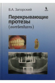 Перекрывающие протезы. Загорский В.А.
